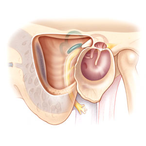 Mastoidectomy