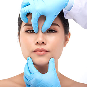 Rhinoplasty